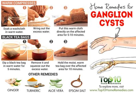 This may help reduce the painful lumps to an extent since it may provide the necessary nutrition and antibodies. . Homeopathic remedies for cysts